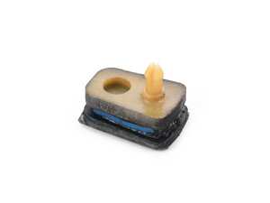 Genuine BMW Stop Buffer - 33526776376 - E70 X5,E71 X6,F15,F16